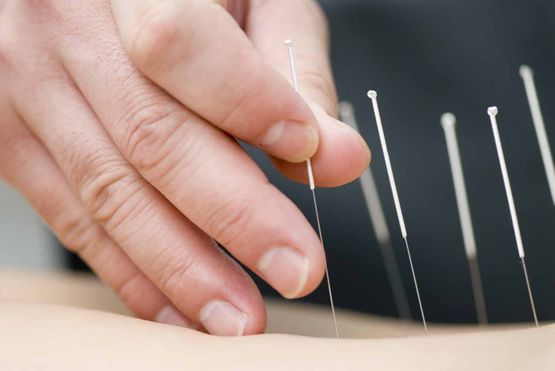 Akupunktur - Praxis für Traditionelle Chinesische Medizin